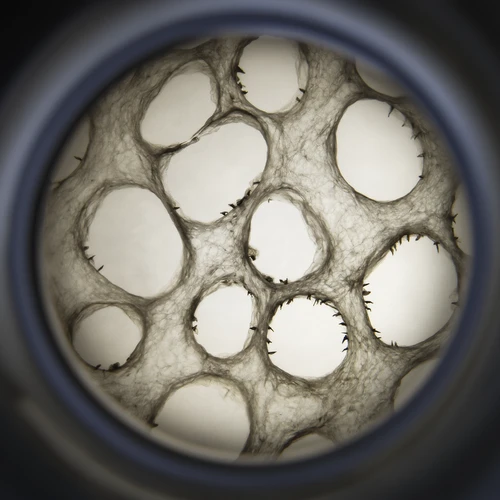 Breast Cancer Cells Invade Fat Tissue to Boost Growth - Can We Block Them?