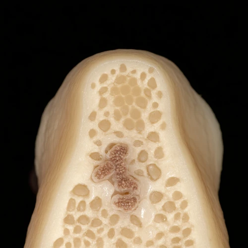 Nasal Polyps: Why They Return & New Treatments